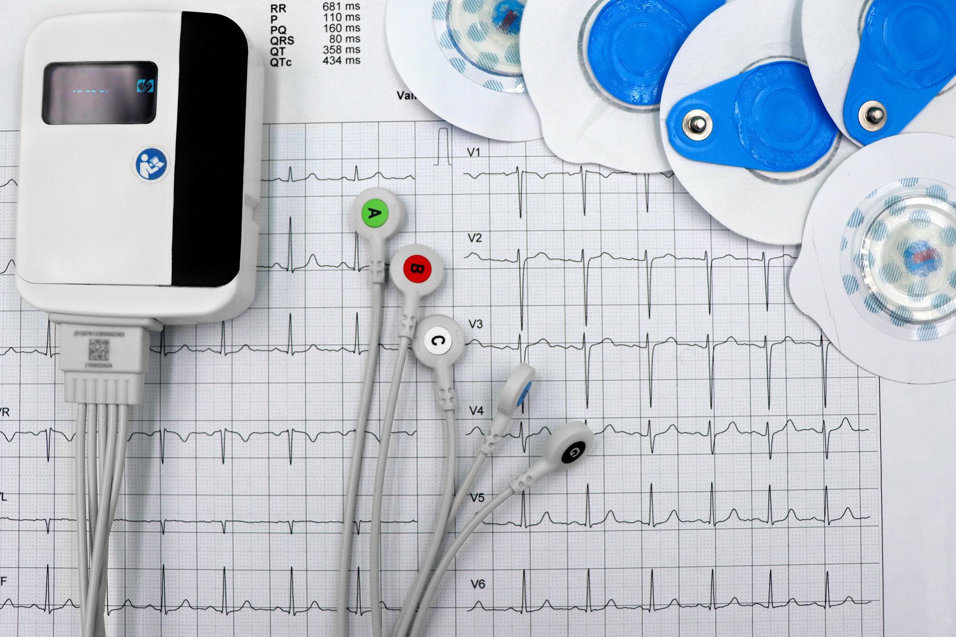 ECG printout displaying waveforms alongside lead wires, showcasing analysis in AI detection tools.